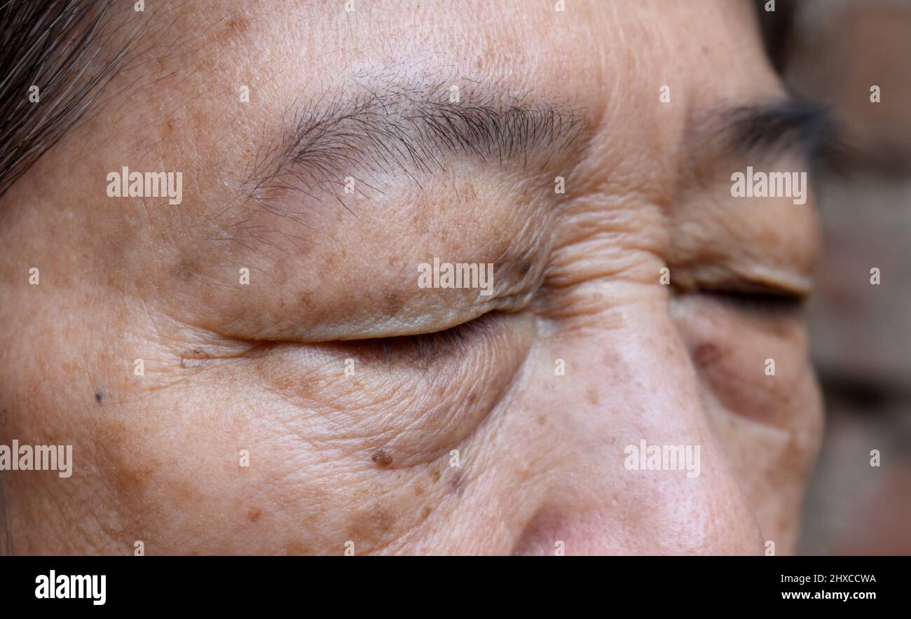 Rughe intorno ad occhio chiuso della donna anziana asiatica. Primo piano. Foto Stock