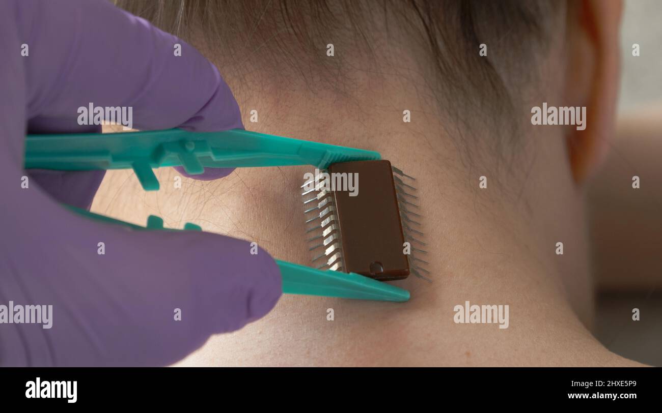 impianto di un microchip sotto la pelle umana. Controllo della mente umana usando la tecnologia del calcolatore. Che identifica la gente. Foto Stock