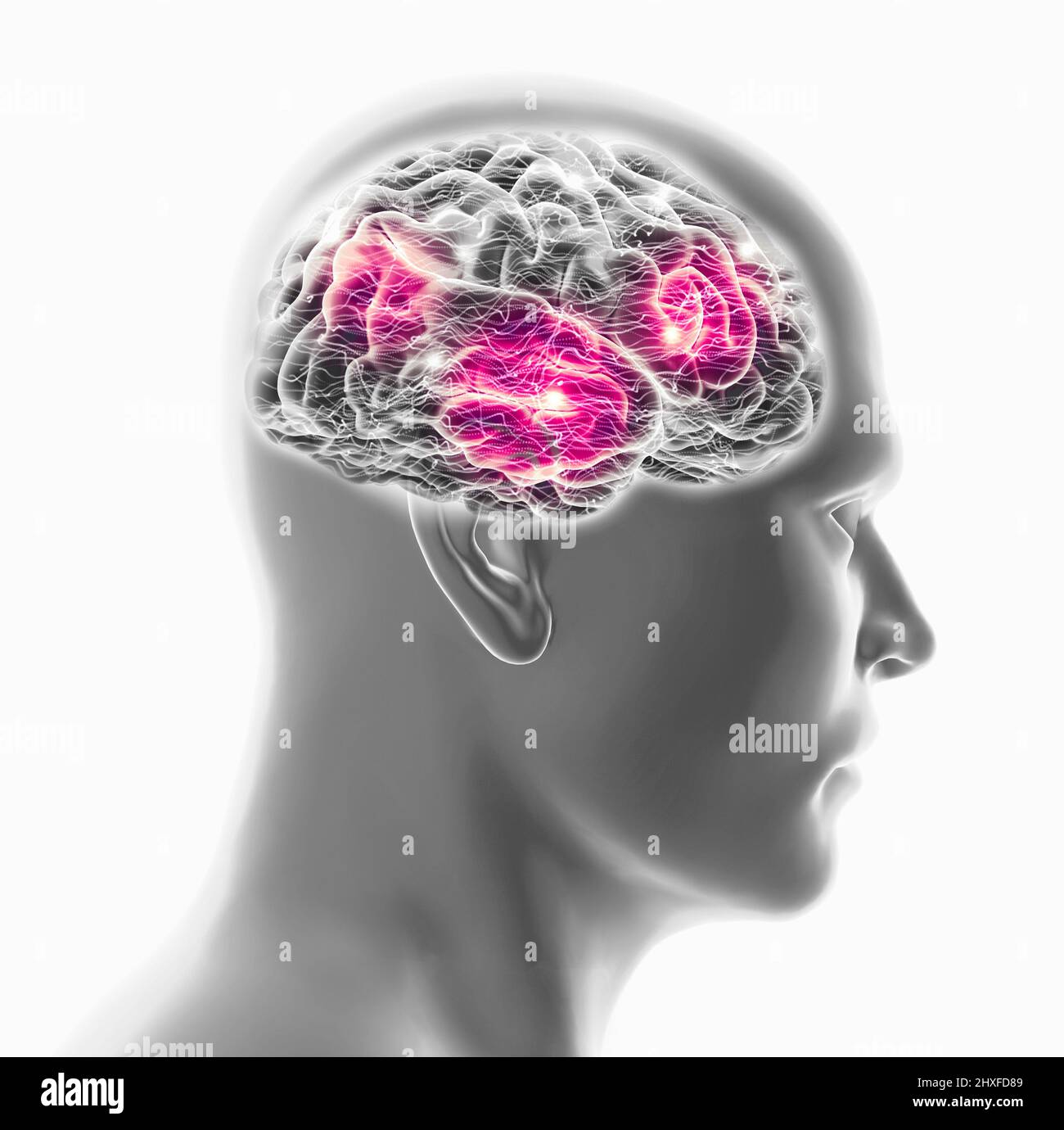 Cervello umano e volto dell'uomo, vista laterale. Raggi X. Malattie degenerative, sinapsi e neuroni, funzionamento del cervello. Ictus e problemi cognitivi. Parkinson Foto Stock