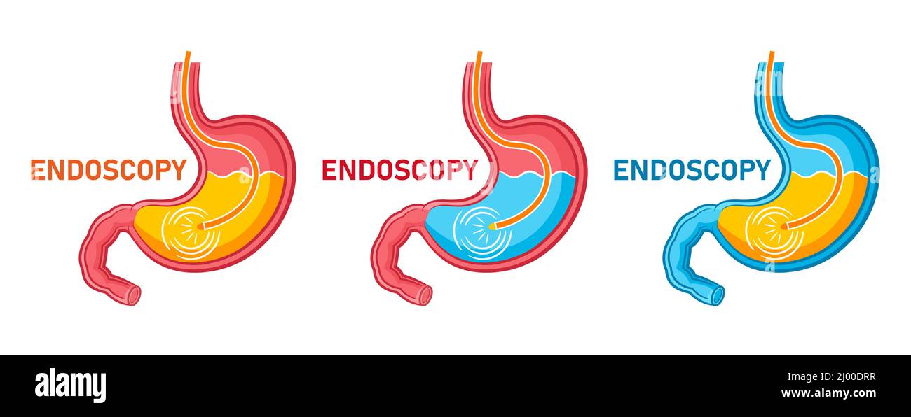 Endoscopia stomaco, icona gastroscopia. Endoscopio gastroenterologico, esame medico del tratto digestivo, trattamento gastrite, ulcera vettore organo interno Illustrazione Vettoriale