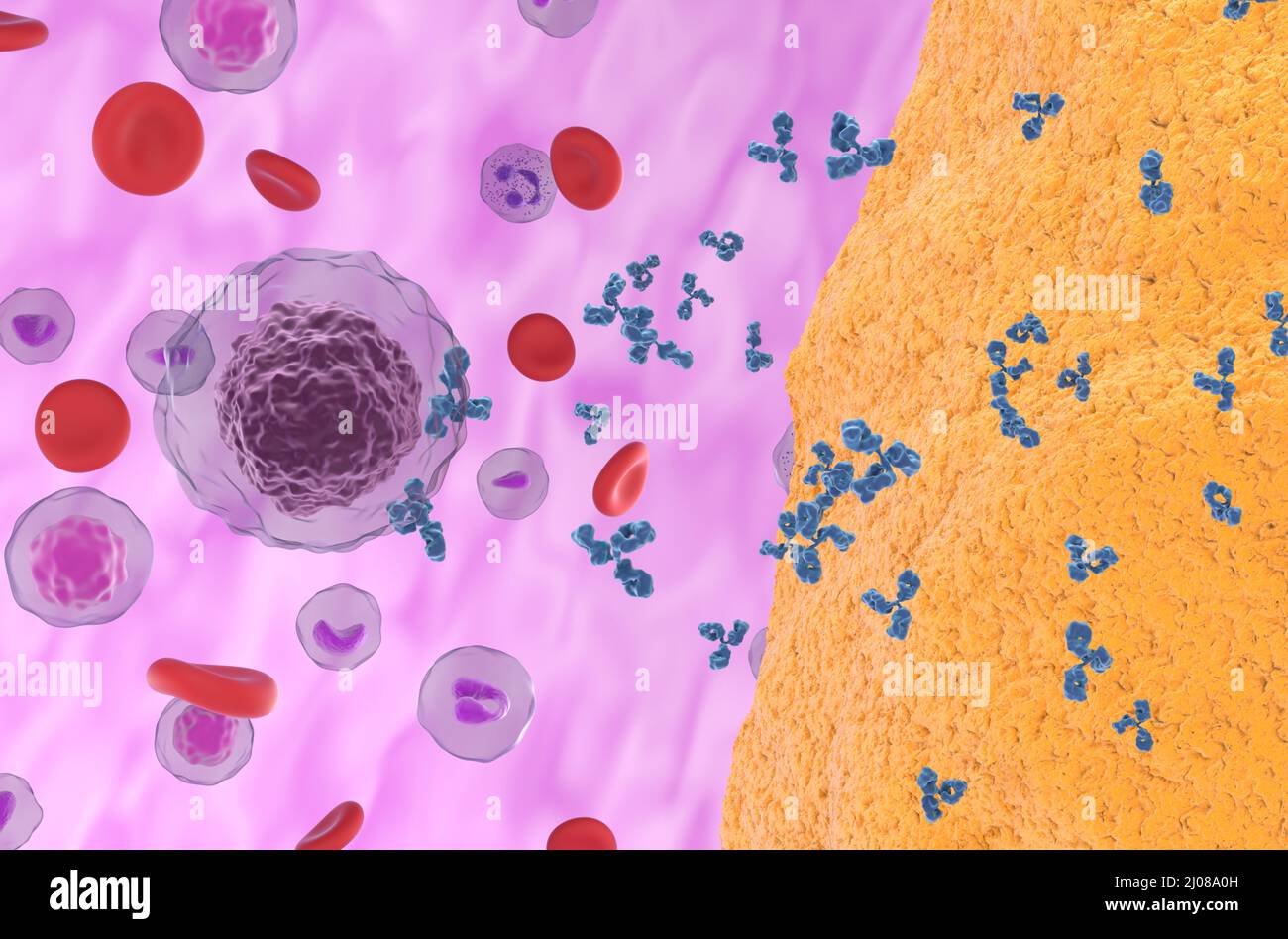 Artrite reumatoide (RA): In una malattia autoimmune faultry attivato b-cellule che emettono anticorpi che attaccano le articolazioni causa infiammazione - isomet Foto Stock