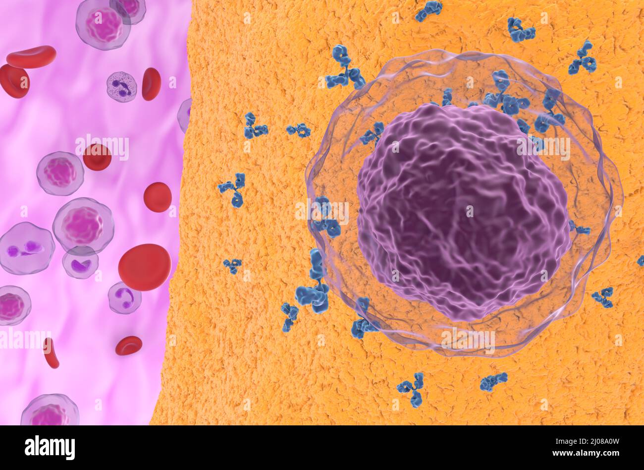 Artrite reumatoide (RA): In una malattia autoimmune faultry attivato b-cellule che emettono anticorpi che attaccano le articolazioni causa infiammazione - anteriore Foto Stock