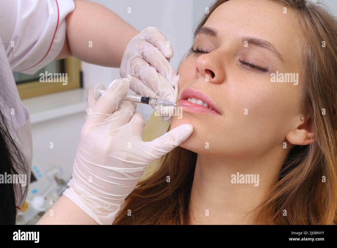 Procedura iniezione riempitivo in clinica di bellezza. Foto Stock