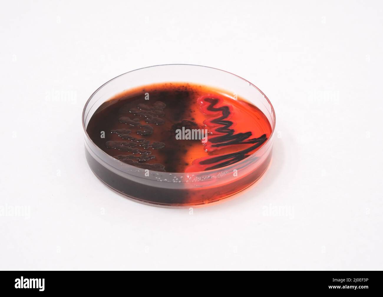 foto della crescita di colonie batteriche nere su agar macconkey Foto Stock