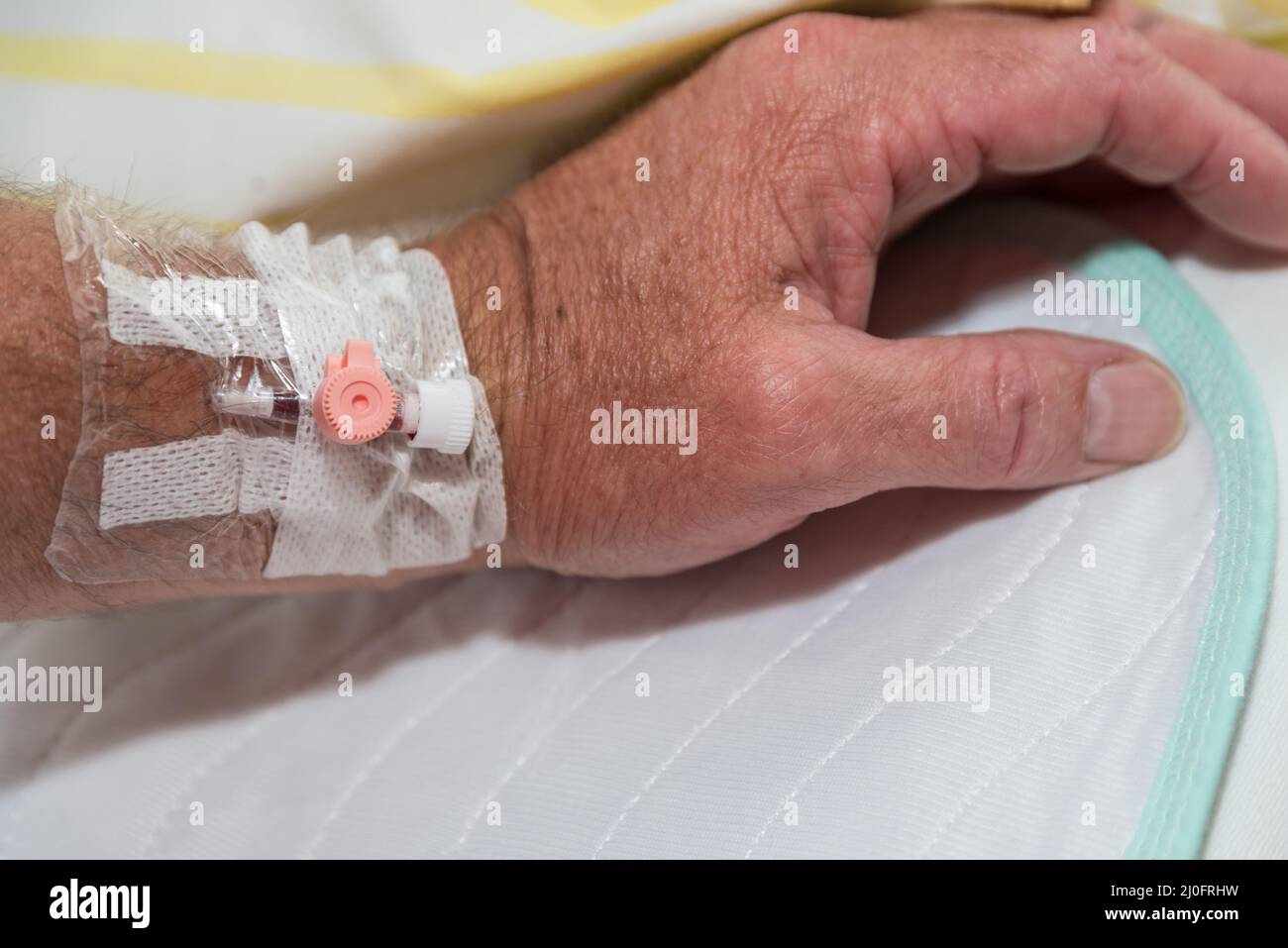 Venflon per prelievo e iniezione di sangue - catetere venoso Foto Stock