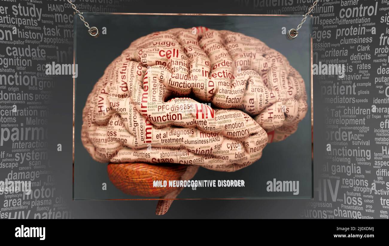 Anatomia del disturbo neurocognitivo lieve - le sue cause e gli effetti proiettati su un cervello umano rivelando la complessità del disturbo neurocognitivo lieve e relatio Foto Stock