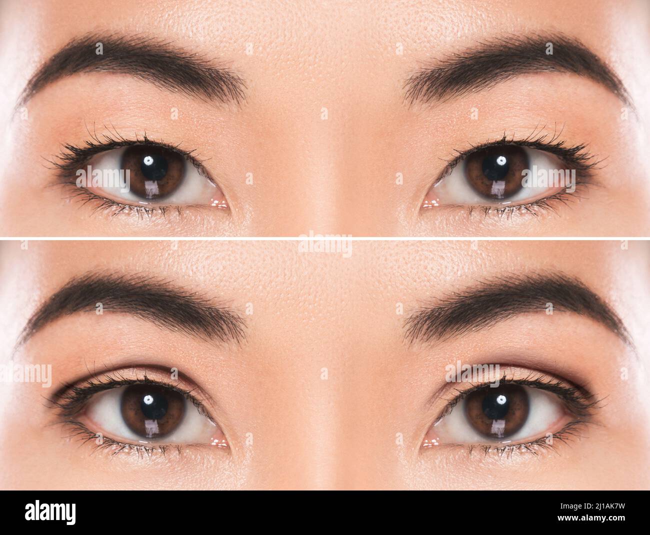 Nastro Invisibile Per Doppia Palpebra Dall'aspetto Naturale - Foto 5