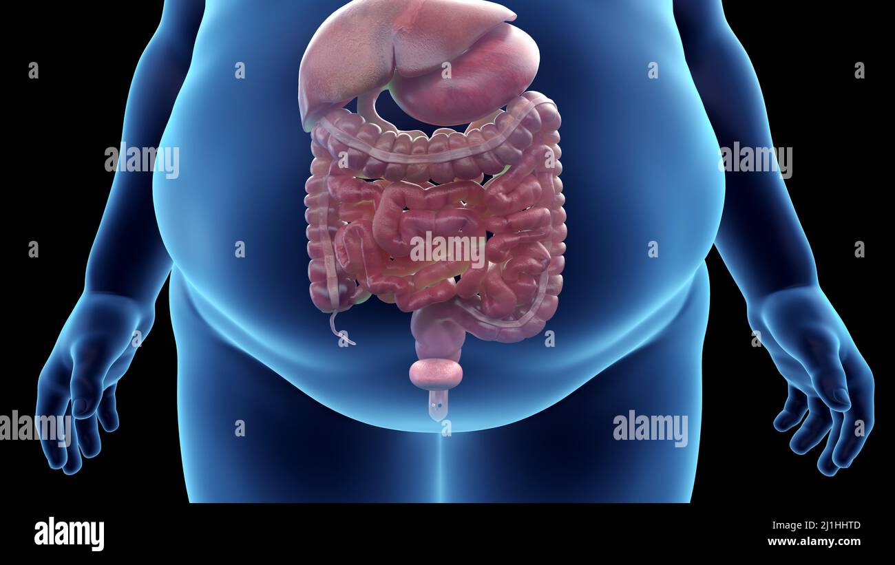 Organi addominali obesi dell'uomo, illustrazione Foto Stock
