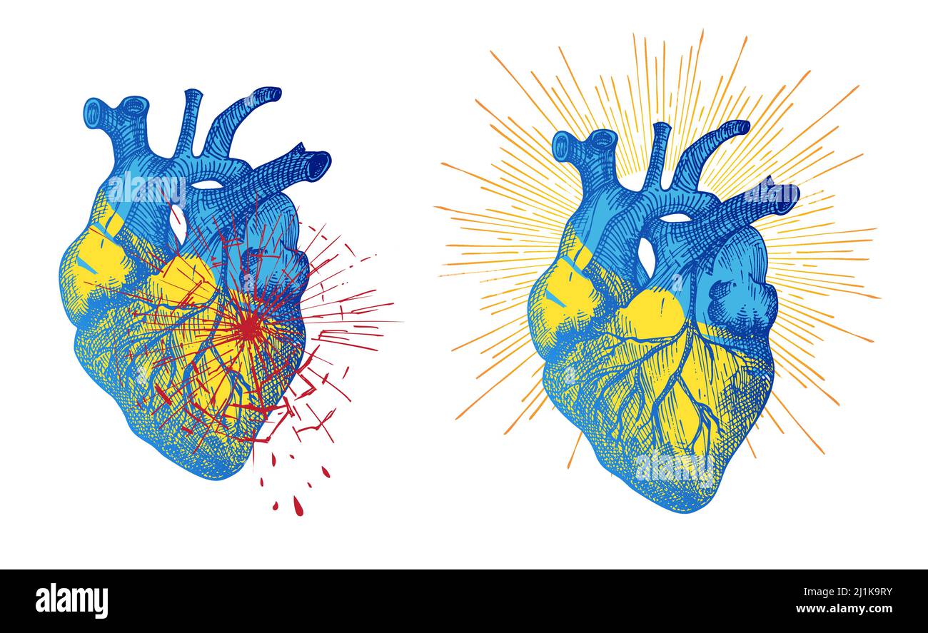 Salva Ucraina, STOP guerra concetto banner design realistico cuore in Nazionale ucraino bandiera colore con rotto vetro struttura e gocce di sangue. Sole come simbolo Illustrazione Vettoriale