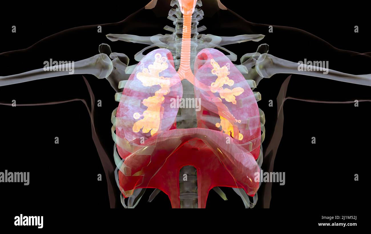 Human Respiratory System polmoni Anatomy Animation Concept. Polmone visibile, ventilazione polmonare, trachea, illustrazione medica realistica di alta qualità 3D Foto Stock