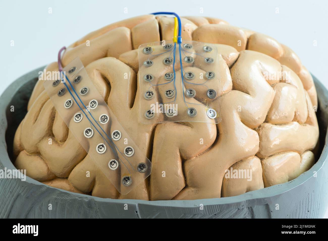Vista ravvicinata dell'elettrodo a griglia subdurale per la registrazione di onde cerebrali o l'elettroencefalografia sulla corteccia del modello cerebrale artificiale Foto Stock