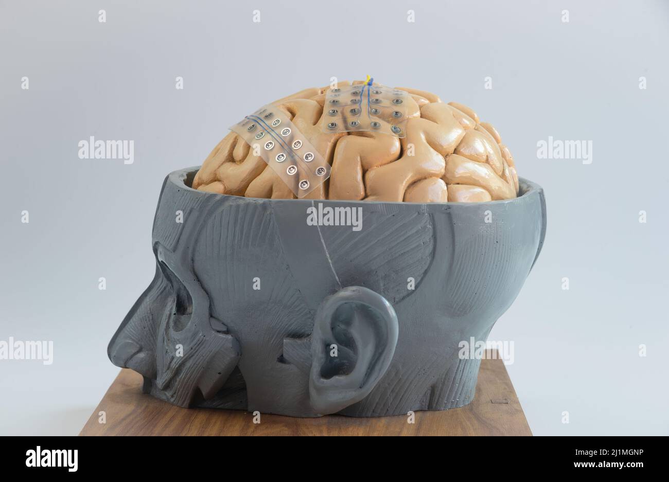 Due di elettrodo a griglia subdurale per la registrazione di onde cerebrali o l'elettroencefalografia sulla corteccia del modello cerebrale artificiale Foto Stock