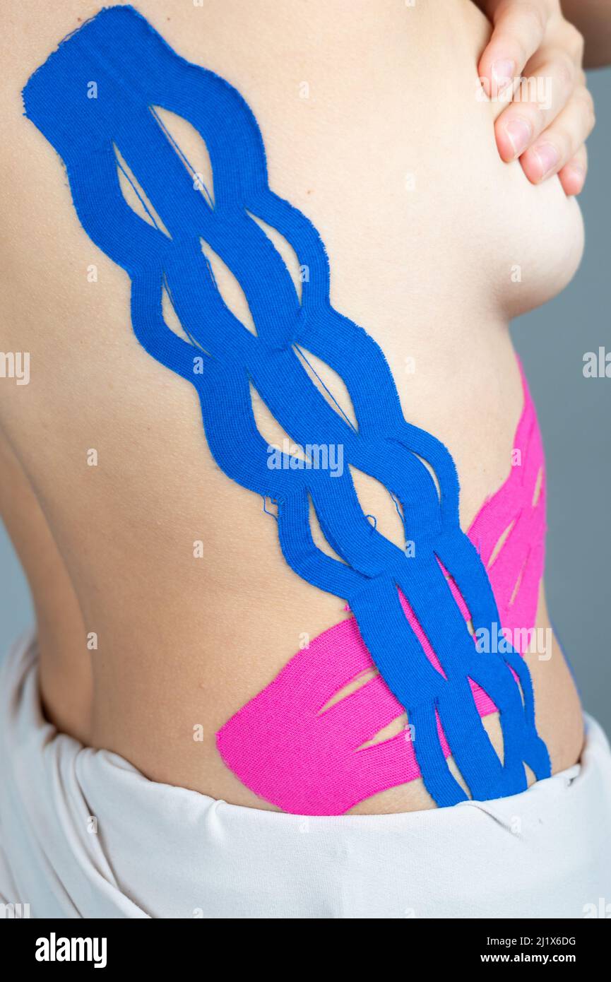 Primo piano del corpo femminile con nastri kinesio. Il tema cinesiologia taping, stretching, trauma e dolore muscolare Foto Stock
