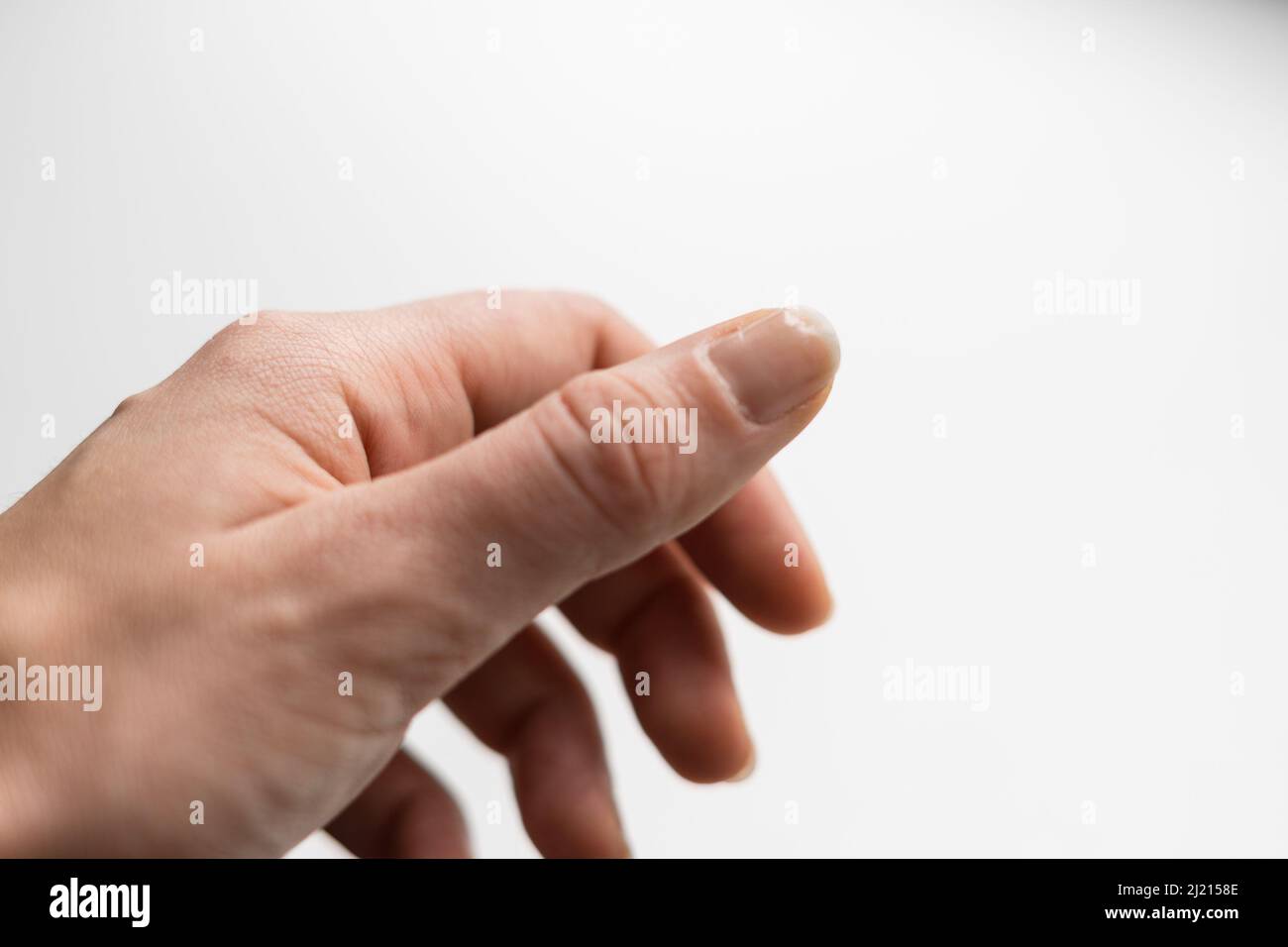 Primo piano di unghie fragili sulla mano della donna. Sfondo bianco. Brocken e unghia asciutta. Deficit di Avitaminosi e microelementi Foto Stock