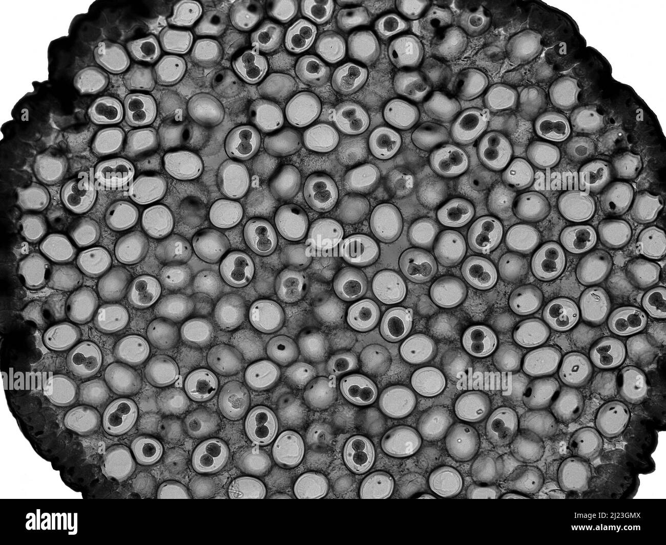 Frammentazione uova di verme di cavallo (Ascaris megalocephala). Micrografia leggera. Stadio Syncarion. Foto Stock