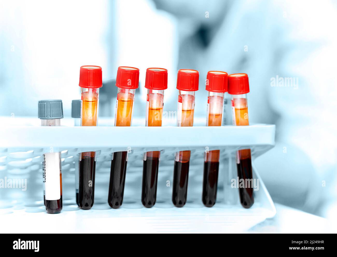 Campioni di sangue in provette. Lavorare in laboratorio. Foto Stock