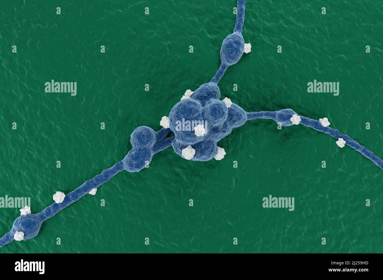 Neuroblastoma cellule tumorali nel sistema nervoso centrale (cancro del cervello) - vista dall'alto 3D illustrazione Foto Stock