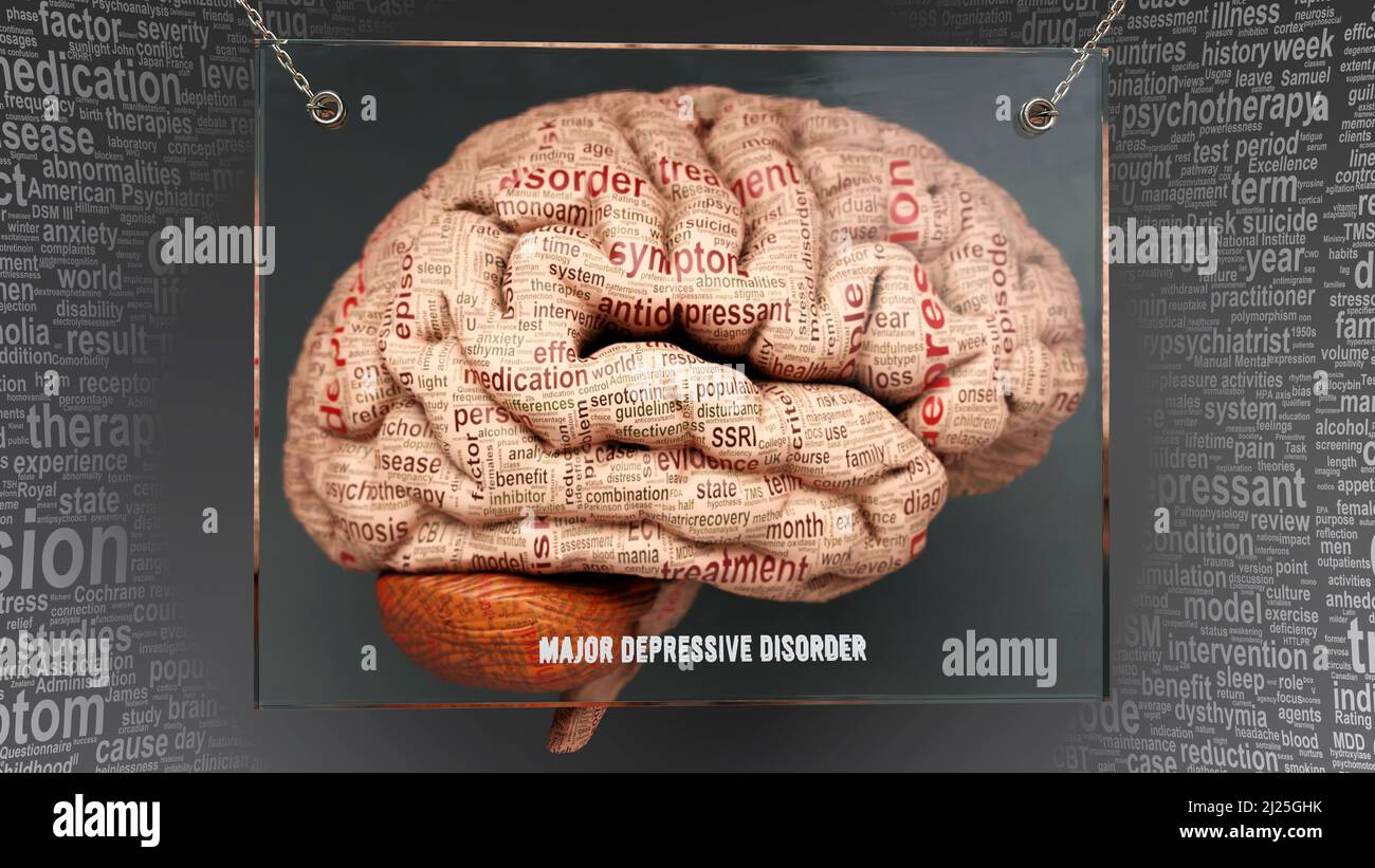 Anatomia del disturbo depressivo maggiore - le sue cause e gli effetti proiettati su un cervello umano rivelando la complessità del disturbo depressivo maggiore e il rapporto con h Foto Stock