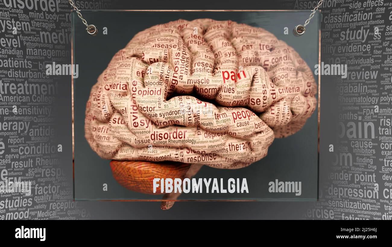 Anatomia fibromialgia - le sue cause e gli effetti proiettati su un cervello umano rivelando la complessità della fibromialgia e il rapporto con la mente umana. Arte concettuale, 3D Foto Stock
