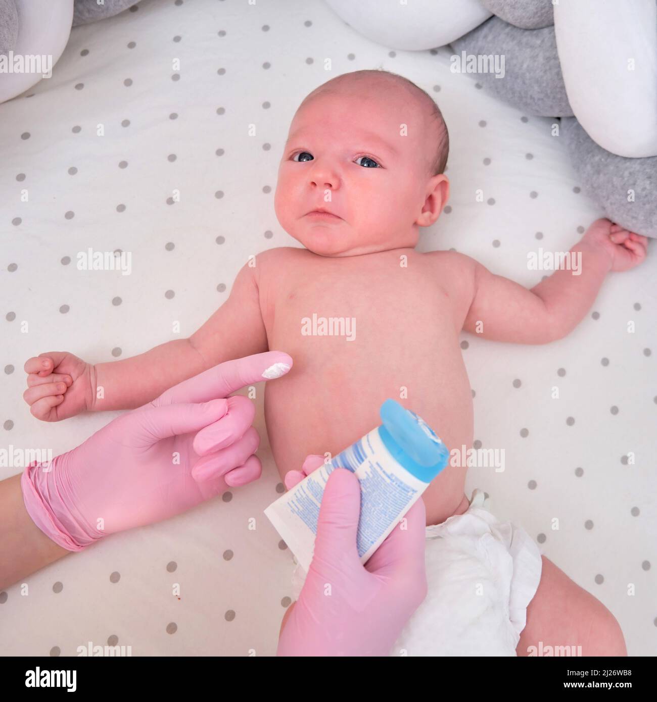 Il medico spalma una crema sulla pelle di un neonato. Infermiere dermatologo in uniforme Foto Stock