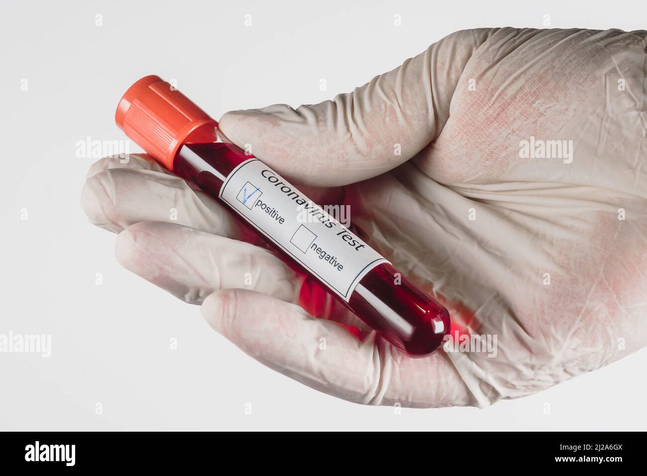 Provetta per vuoto con un campione di sangue con risultato positivo per l'infezione da Covid-19 in mano con un guanto medico su sfondo bianco Foto Stock