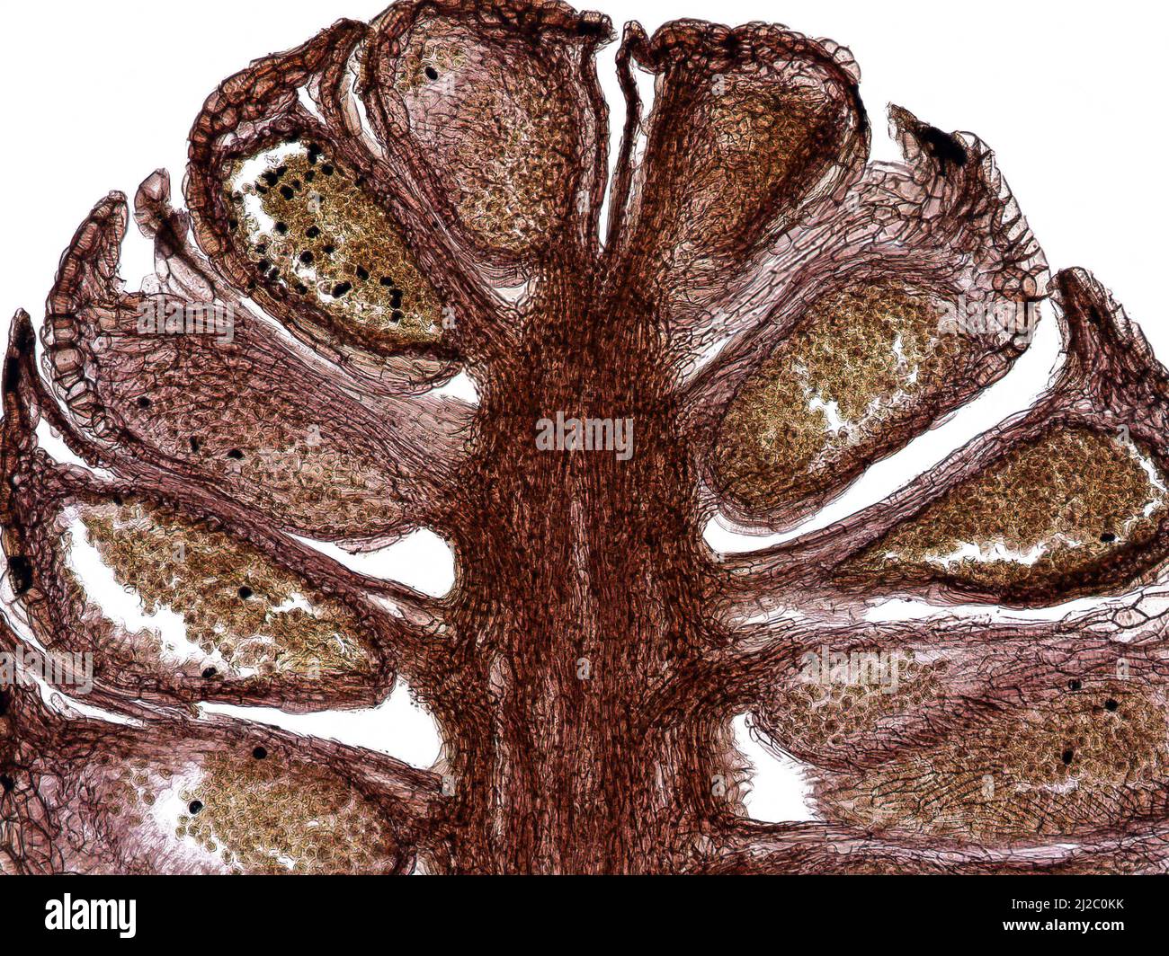 Sezione longitudinale del cono di pino maschile (Pinus sylvestris) al microscopio, che mostra microsporangio con grani di polline. Struttura istologica. Foto Stock