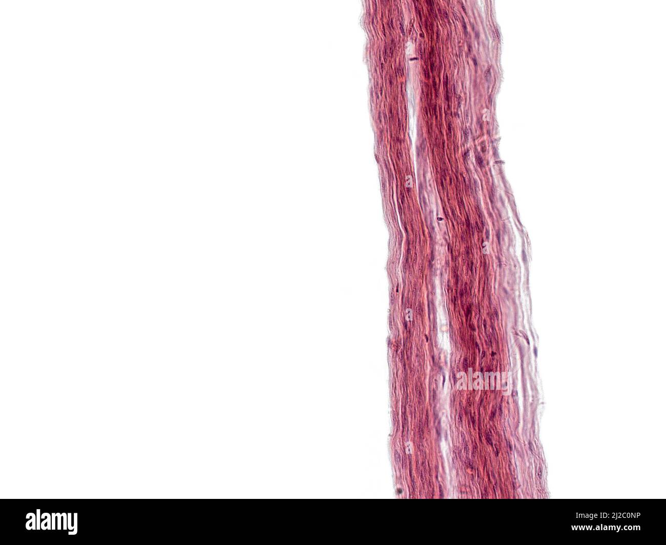 Una foto interessante scattata al microscopio. Fibre non mielinate nei nervi periferici. Sezione longitudinale. Ematossilina ed Eosina colorante. Foto Stock