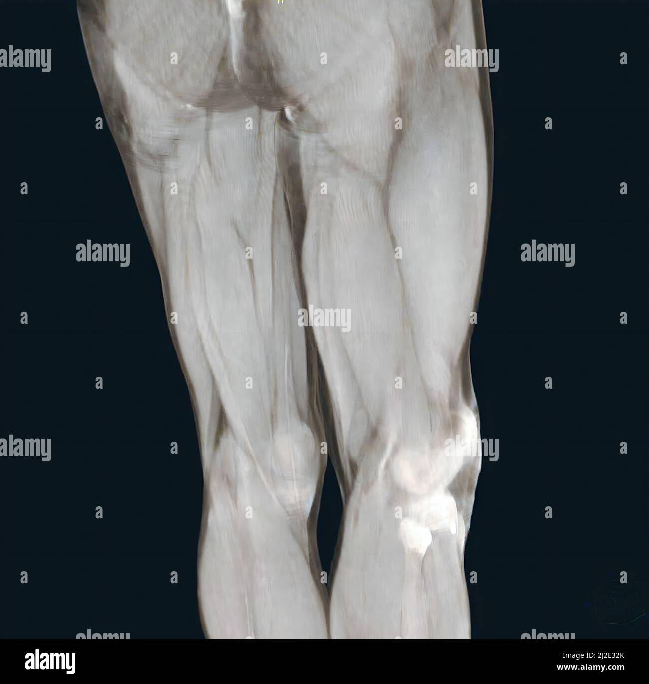 Muscolo, scansione Foto Stock