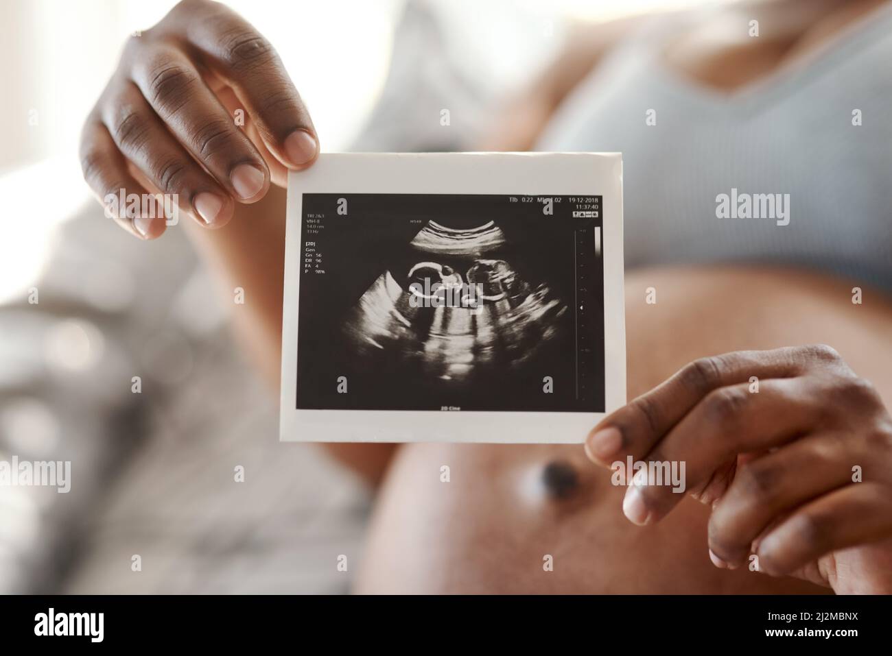 Il cerchio della vita è un'esperienza così miracolosa. Primo piano di una donna irriconoscibile che tiene un sonogramma a casa. Foto Stock