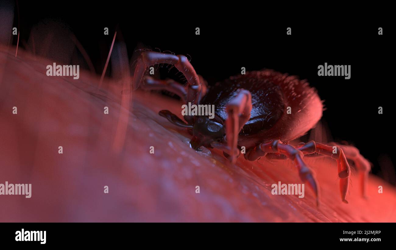 Tick mordere la pelle umana, illustrazione Foto Stock