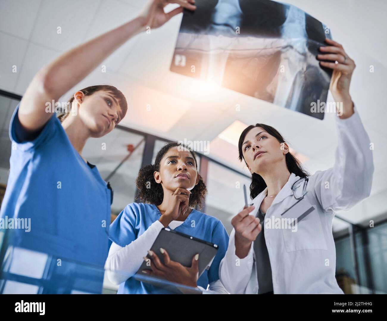 Tutto diventa più chiaro. Shot di un gruppo di medici che discutono i risultati di una radiografia in un ospedale. Foto Stock