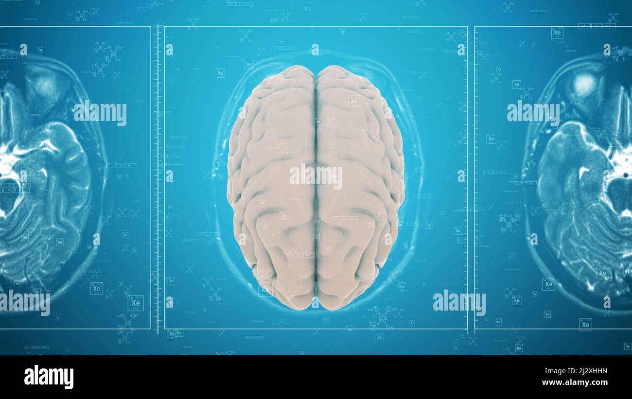 Attività cerebrale umana generata dal computer in MRI Foto Stock