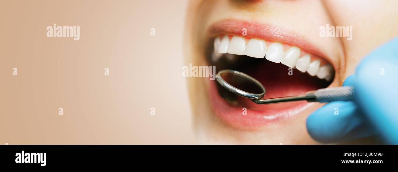 sorriso perfetto. il dentista esamina i denti del woman. bocca controllo igiene orale. spazio per la copia del banner Foto Stock