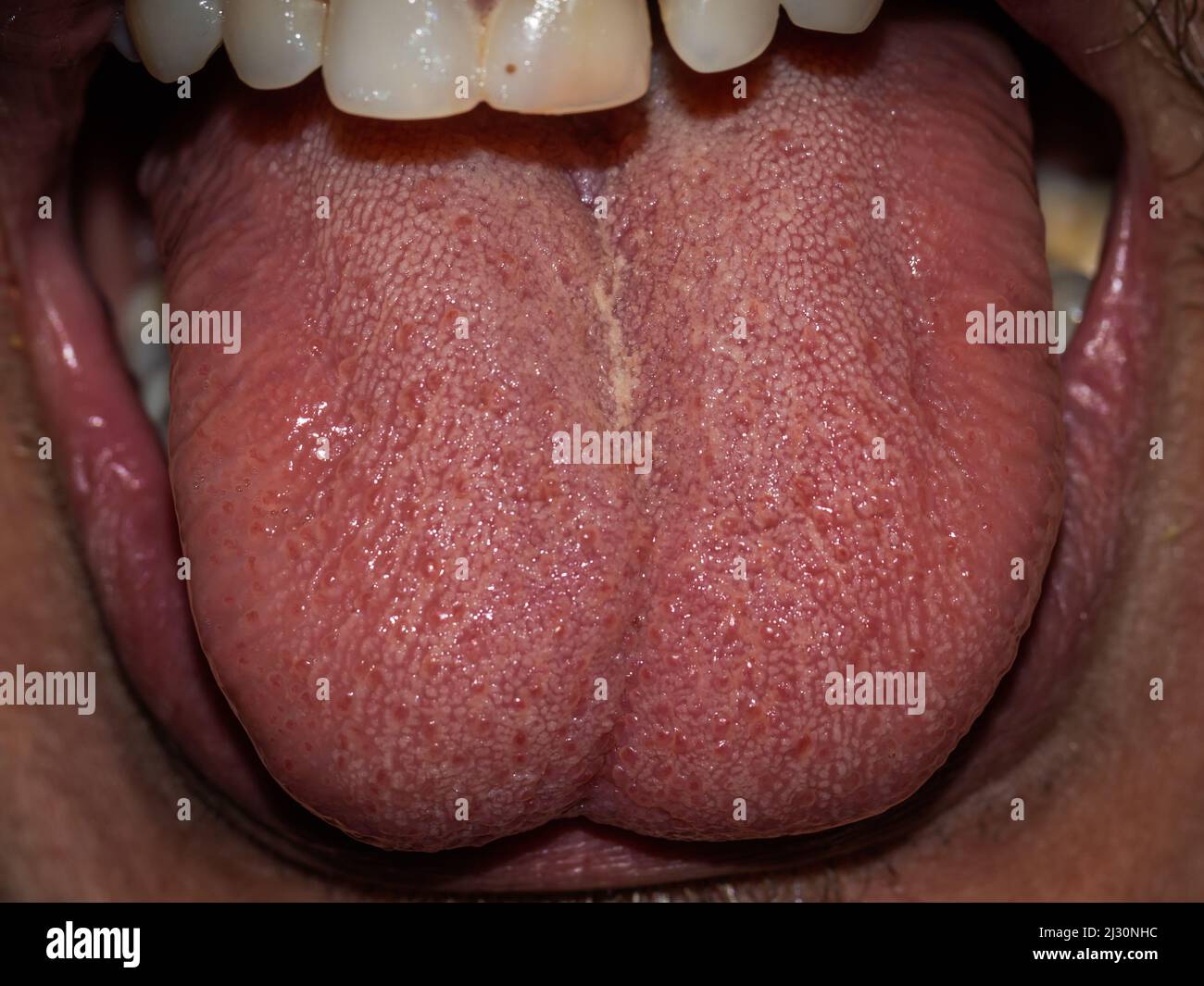Vista ravvicinata dettagliata che mostra la consistenza di una lingua umana sana circondata da denti ben mantenuti, sottolineando la salute e l'igiene orale Foto Stock