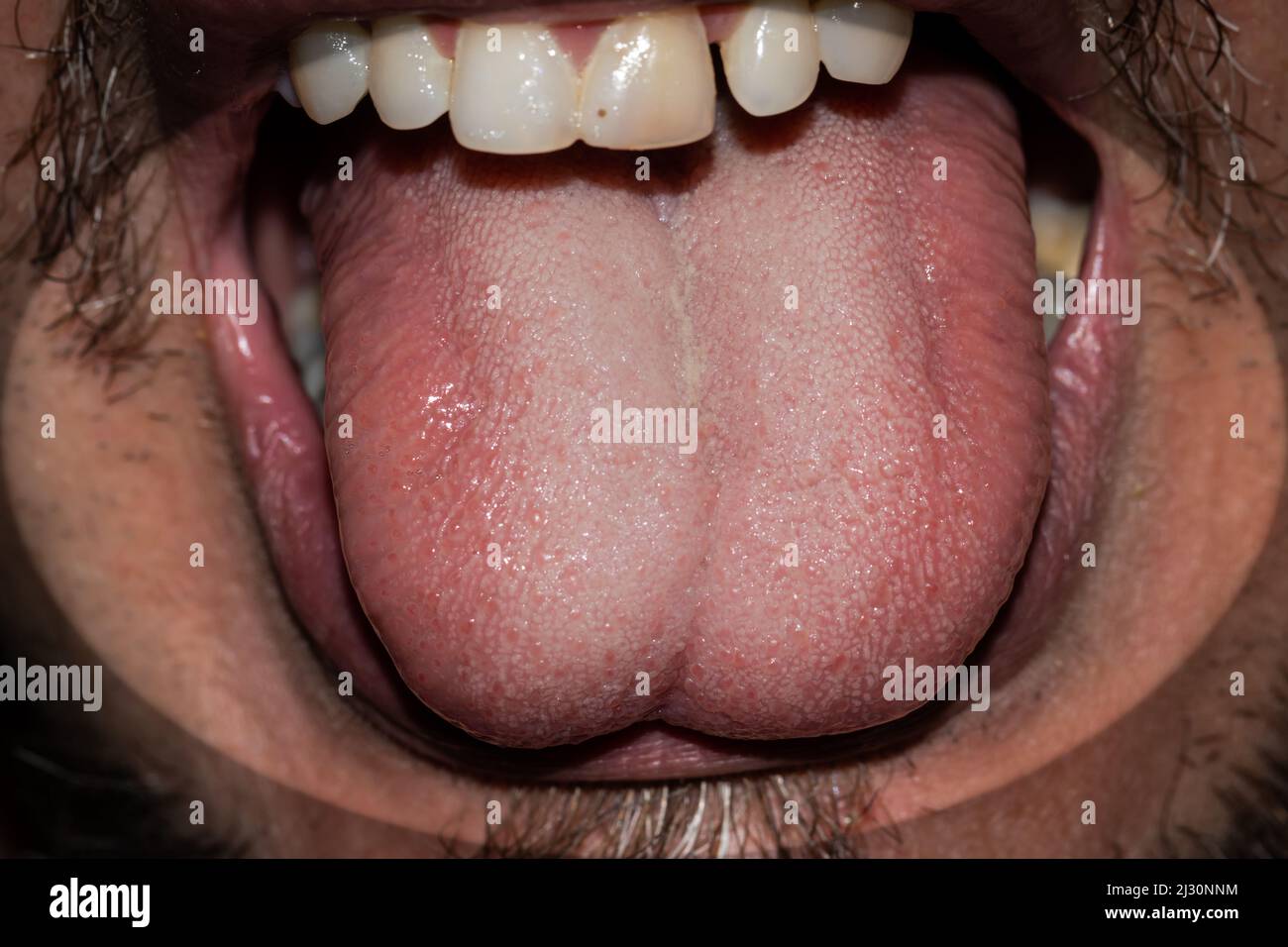 Vista ravvicinata dettagliata che mostra la consistenza di una lingua umana sana circondata da denti ben mantenuti, sottolineando la salute e l'igiene orale Foto Stock