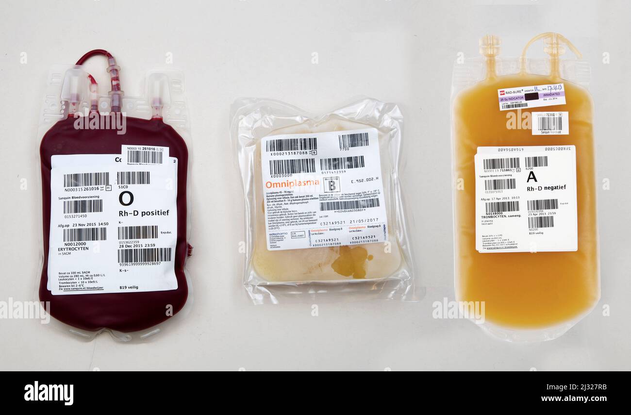 Da sinistra a destra: Estratto di globuli rossi o eritrociti. Estratto di piastrine, chiamato anche trombociti Omnplasma-A aggregati, trattati con SD e pri Foto Stock