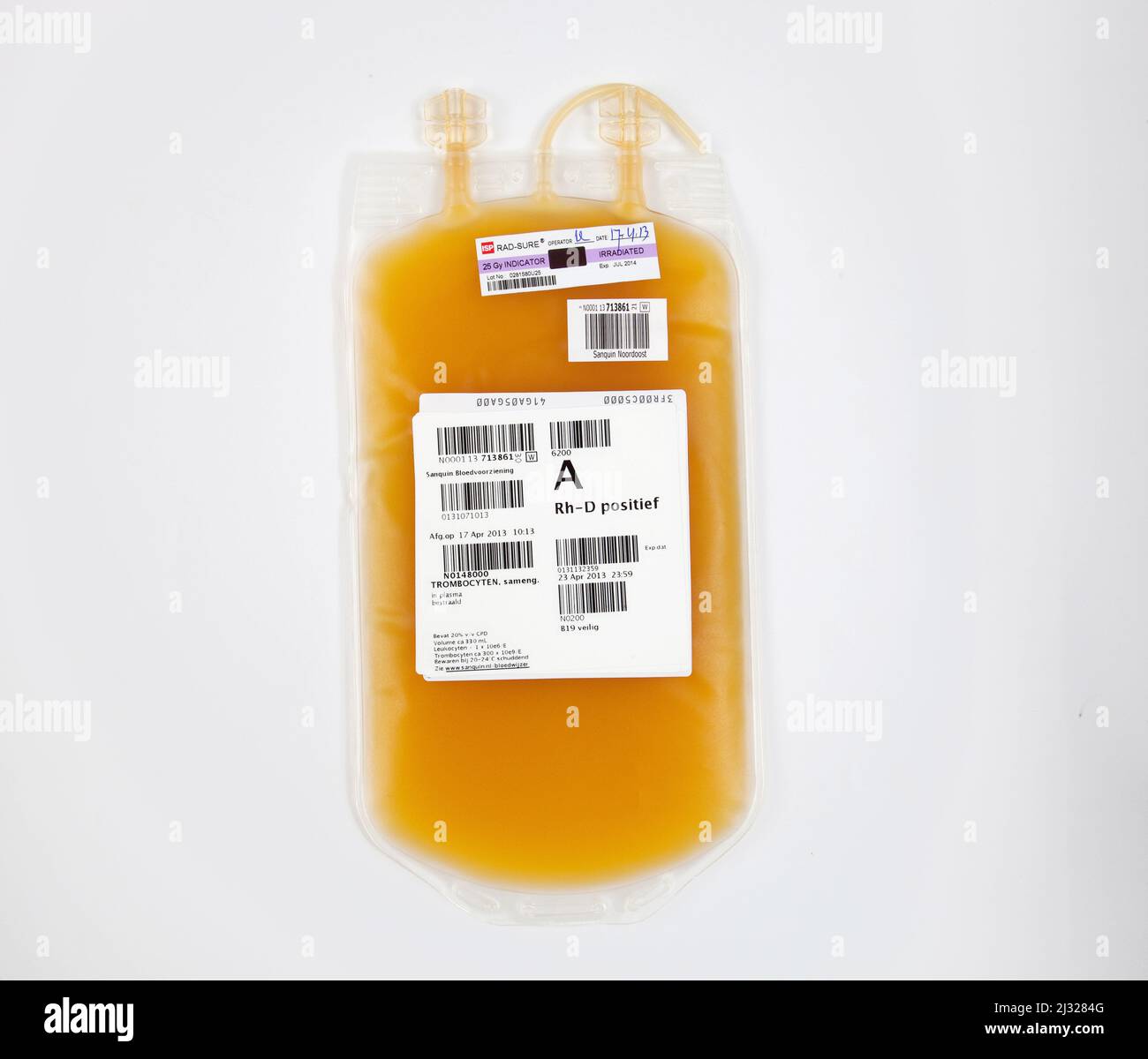 Una sacca per infusione con estratto di piastrine, detti anche trombociti. Foto Stock