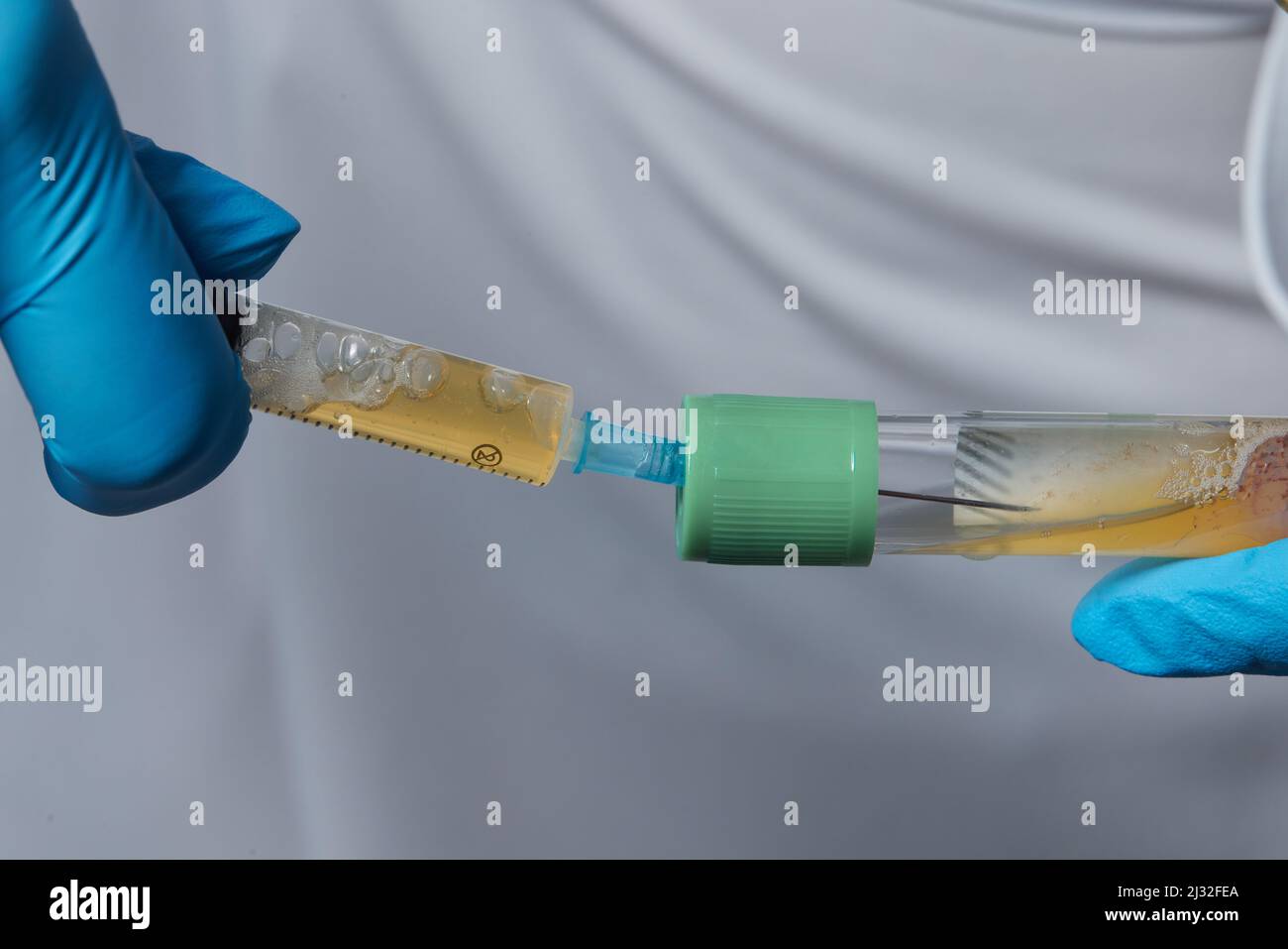 Le mani del medico estetista mettono la provetta con il sangue nel contenitore per centrifuga. Procedura di ringiovanimento del plasmolifting Foto Stock
