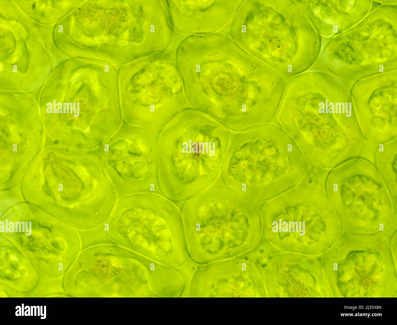 Cellule a foglia verde (Chamaenerion angustifolium) al microscopio Foto Stock
