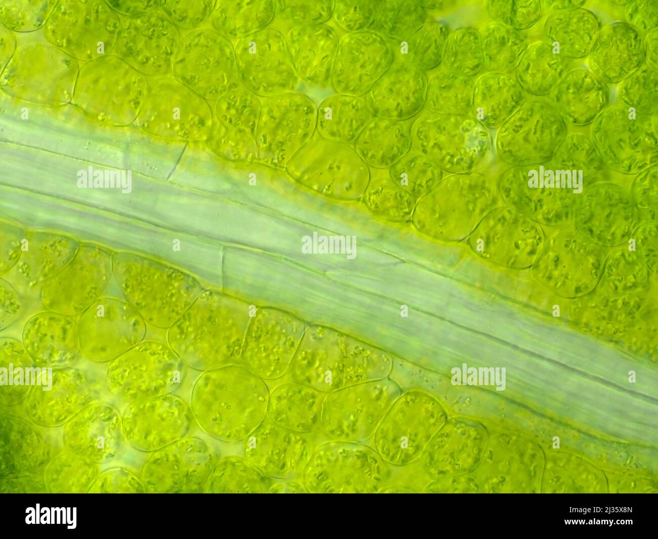 Foglia verde di alghe (Chamaenerion angustifolium) al microscopio Foto Stock