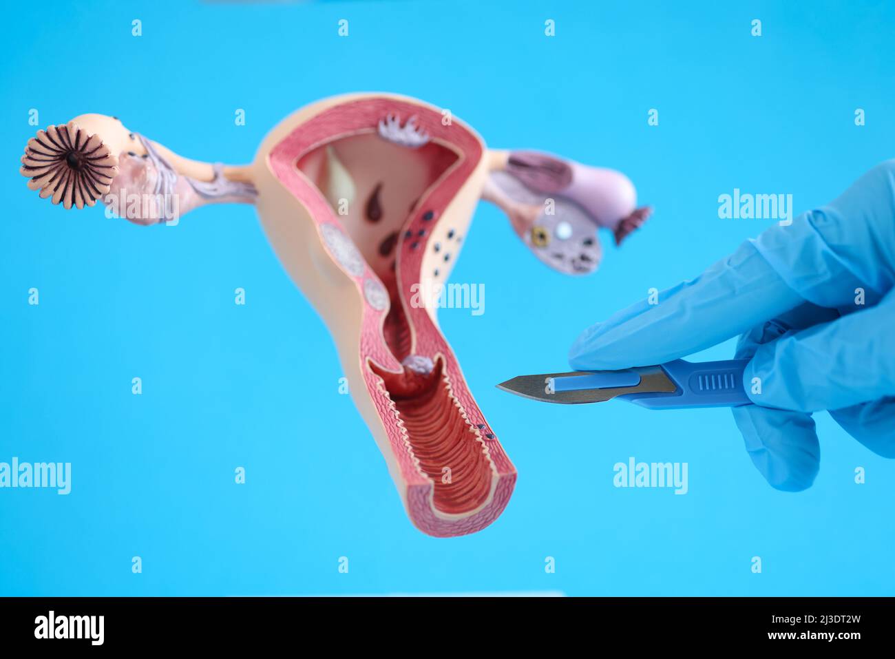 Anatomia del sistema riproduttivo femminile utero e closeup bisturi Foto Stock