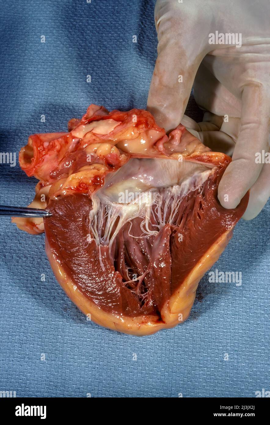 Cuore umano che mostra l'endocardio e il miocardio con valvola mitrale Foto Stock