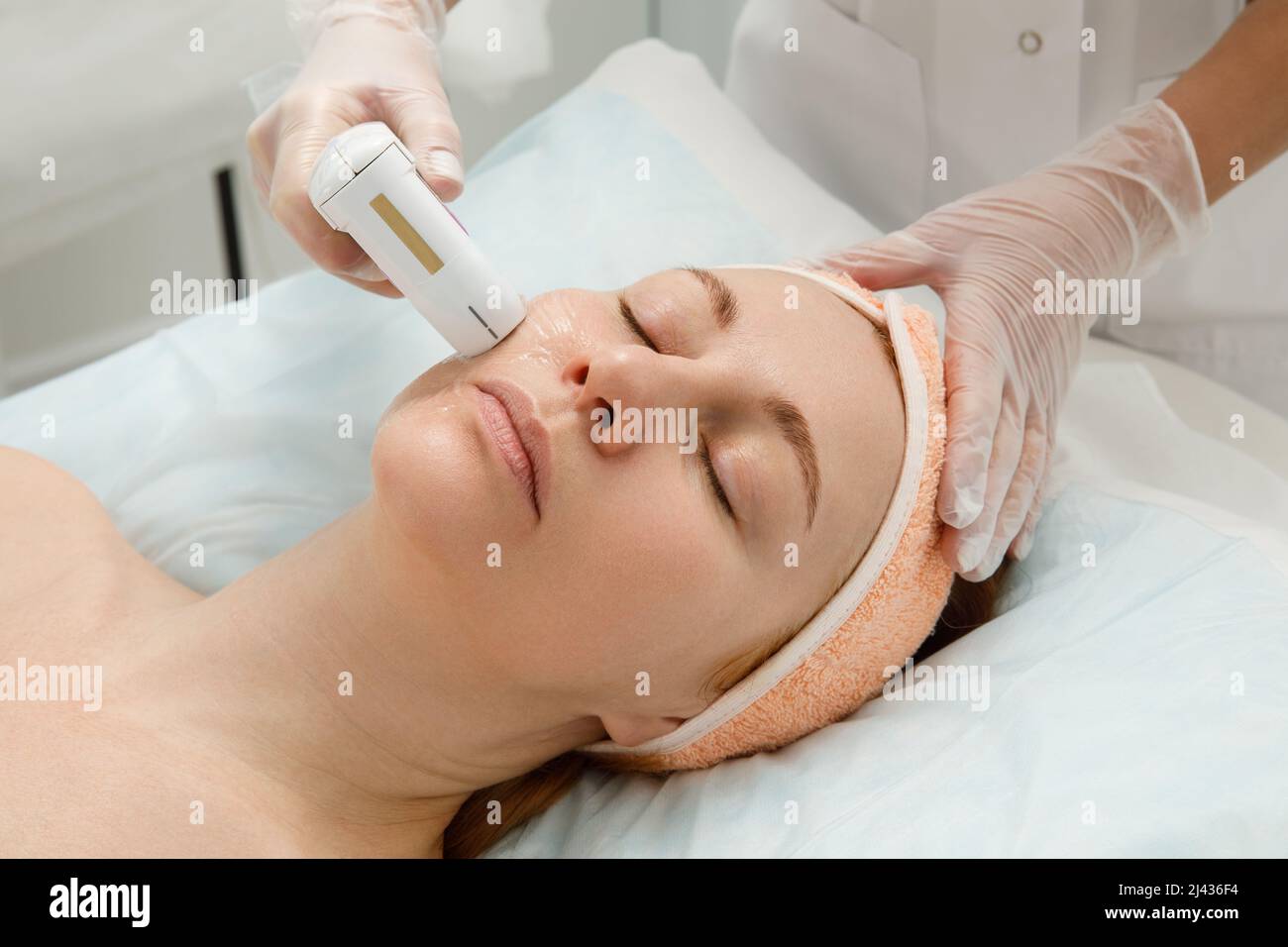 Una donna riceve il trattamento laser del viso in una clinica cosmetologica, un concetto di ringiovanimento della pelle è in fase di sviluppo. Laser peeling Foto Stock