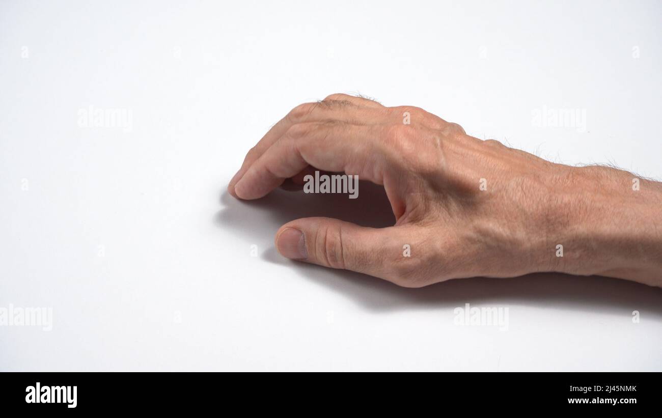 Mutazioni nella polineuropatia sensorimotoria assonale adulta. Foto Stock