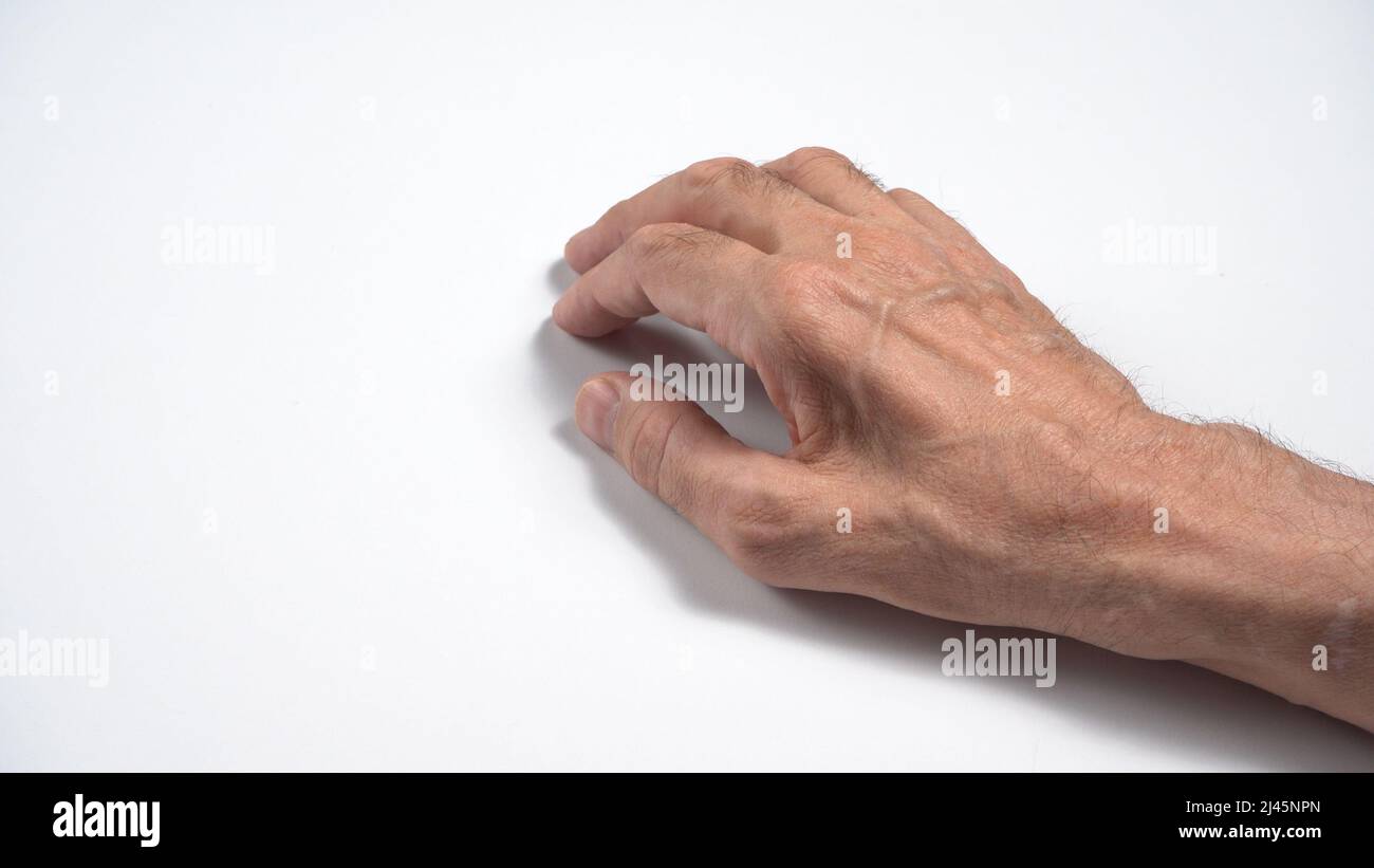 Mutazioni nella polineuropatia sensorimotoria assonale adulta. Foto Stock