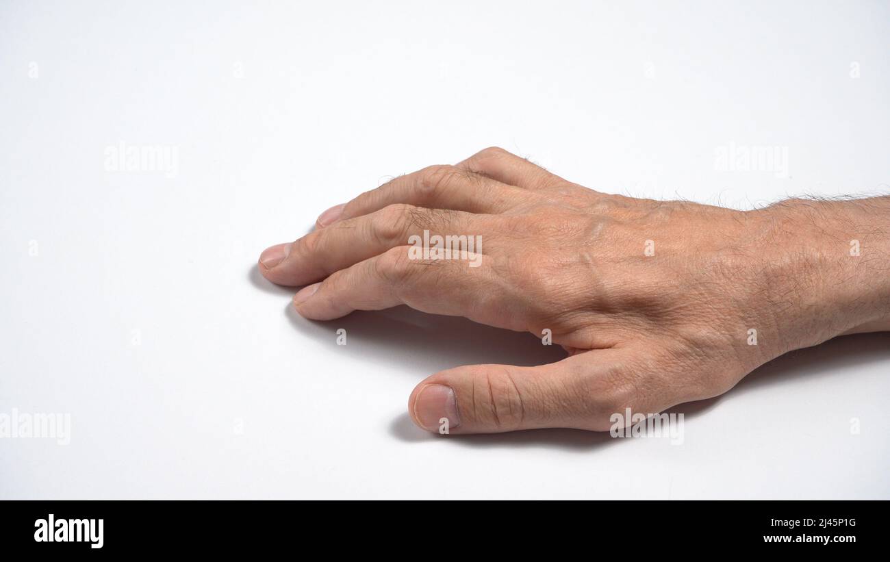 Mutazioni nella polineuropatia sensorimotoria assonale adulta. Foto Stock