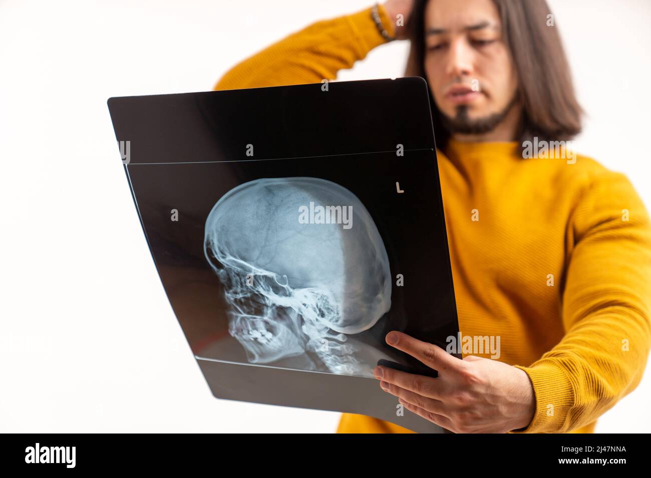 L'uomo caucasico portava il cranio con raggi X indossando una felpa gialla. Isolato su sfondo bianco. Foto di alta qualità Foto Stock