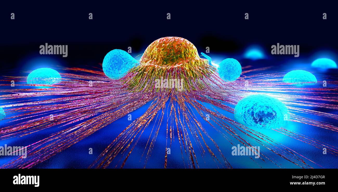 Cellule di linfociti nel sistema immunitario che reagiscono e attaccano una cellula di cancro che si diffonde - illustrazione 3D Foto Stock