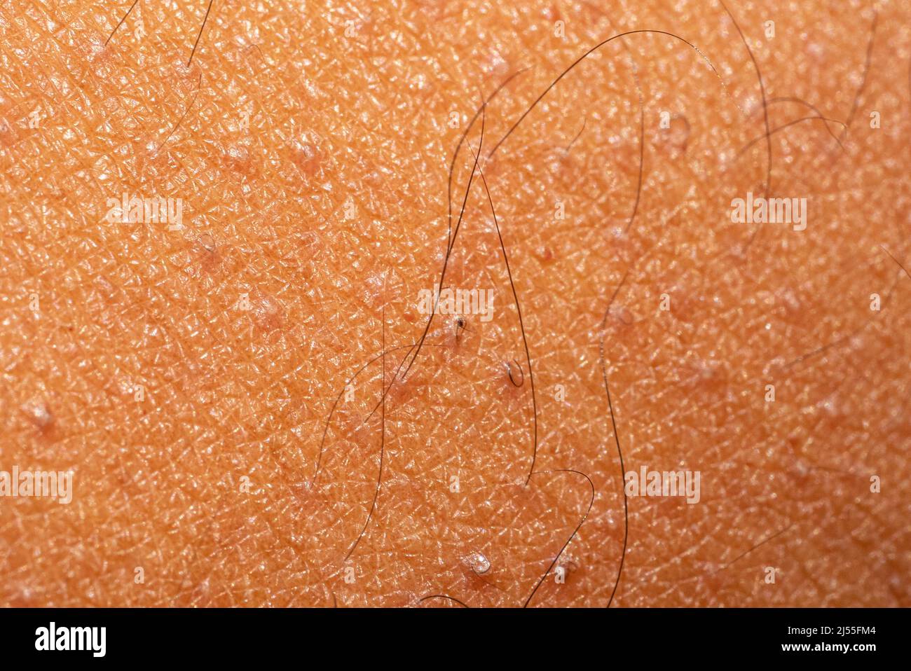 Macrofono di pelle marrone con cheratosi pilaris e peli incarniti. Il dettaglio e la texture della pelle sono chiaramente visibili. Foto Stock