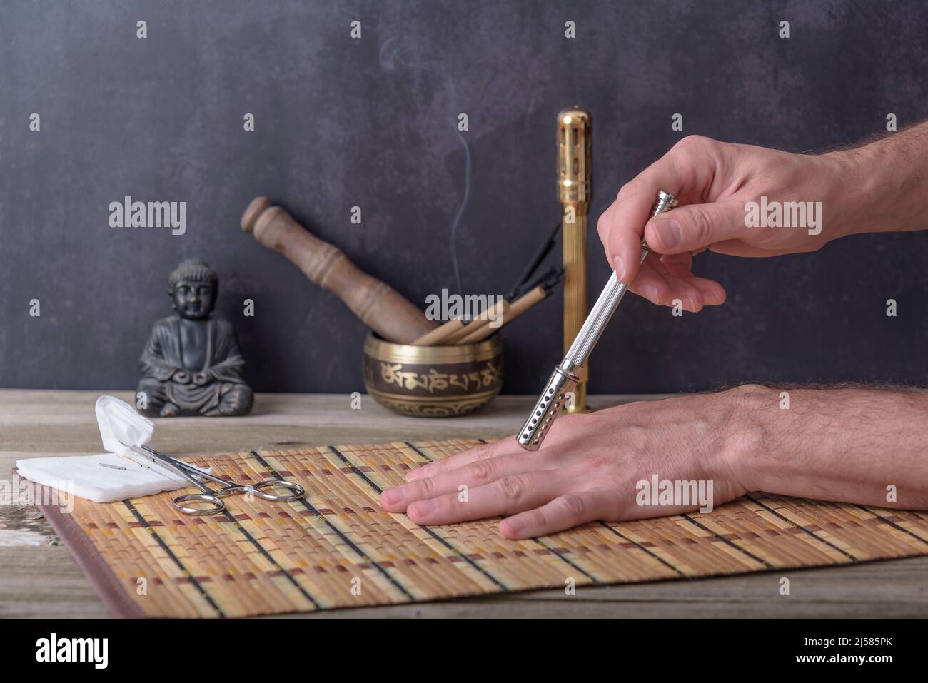 Moxibustion terapia - Medicina tradizionale Cinese. Posizionamento del bastone moxa che brucia sulla mano. Foto Stock